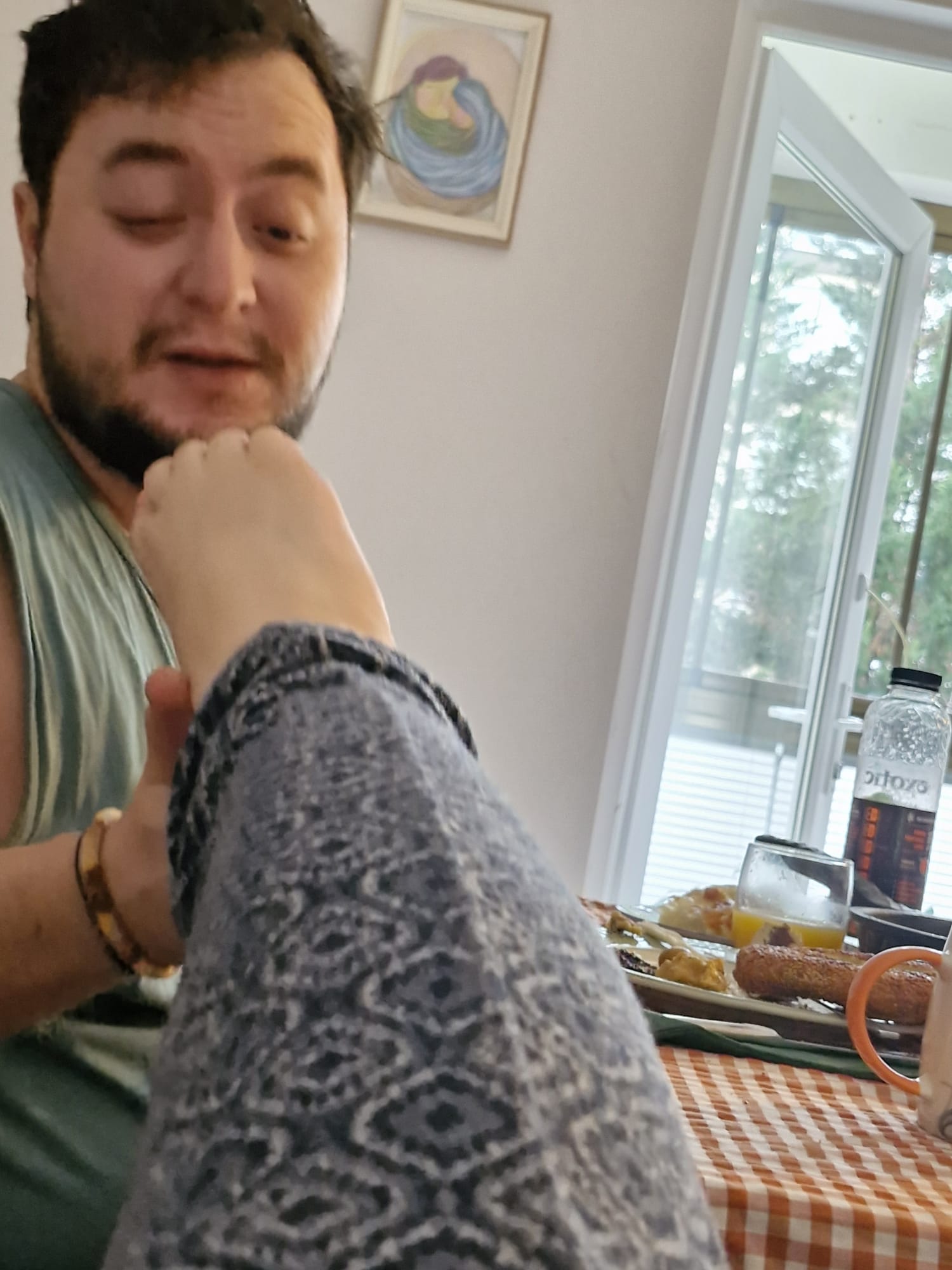 Kırık Ayak ve Sevgi Dolu Bakım